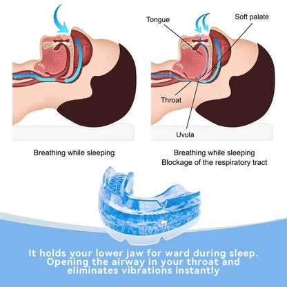 Adjustable Sleep Mouthpiece BPA-Free & Flexible Comfortable Fit