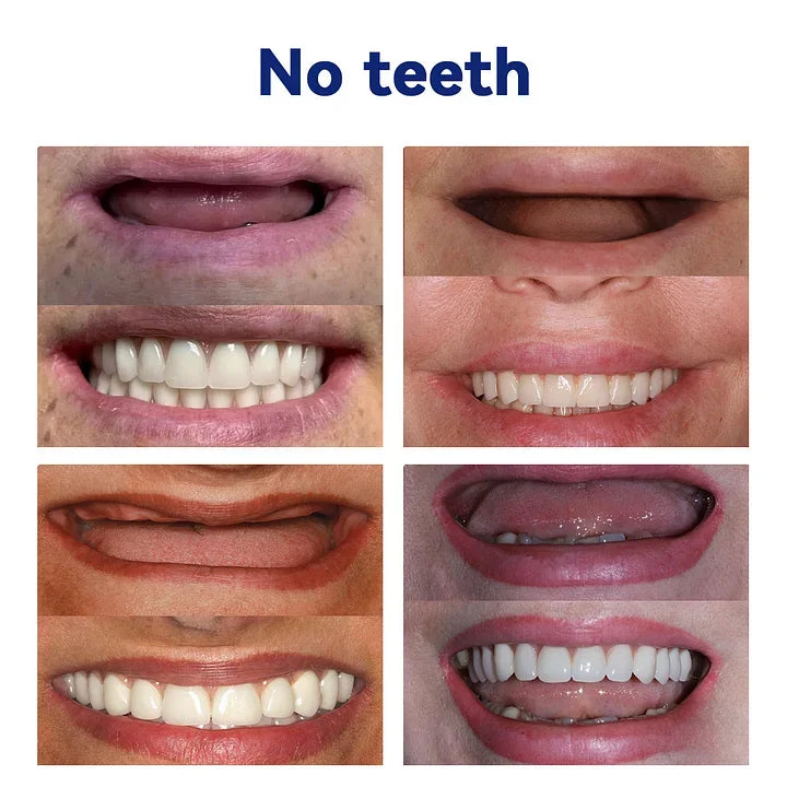 Dentures Flexible Full or Partial Fit Natural-Looking
