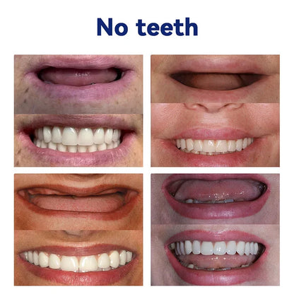 Dentures Flexible Full or Partial Fit Natural-Looking