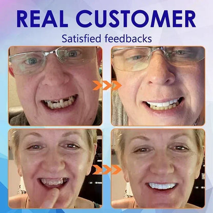 Dentures Flexible Full or Partial Fit Natural-Looking