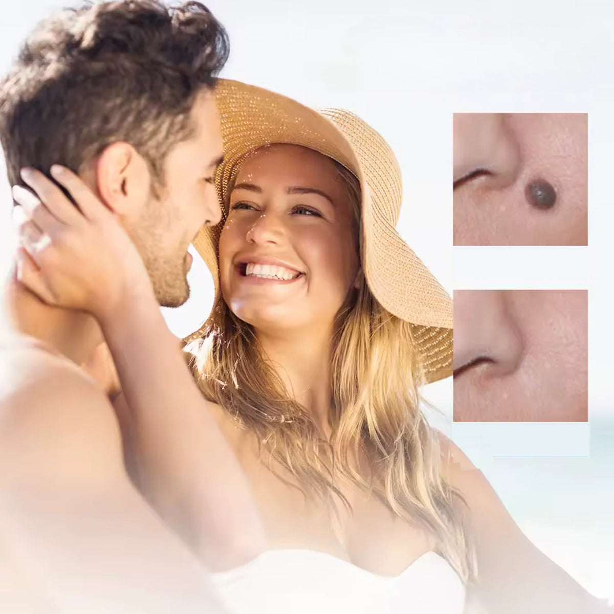 Skin Tag Removal Bands Silicone Chemical Free 40 Pack